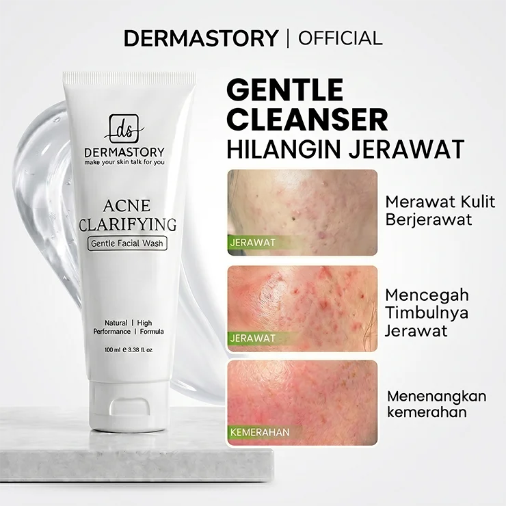 DERMASTORY Sabun Cuci Muka Jerawat Acne Clarifying Gentle Facial Wash 100ml